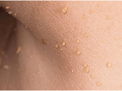 Papilloma movie